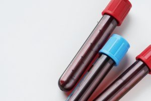 Jakie badania krwi dla kobiet?