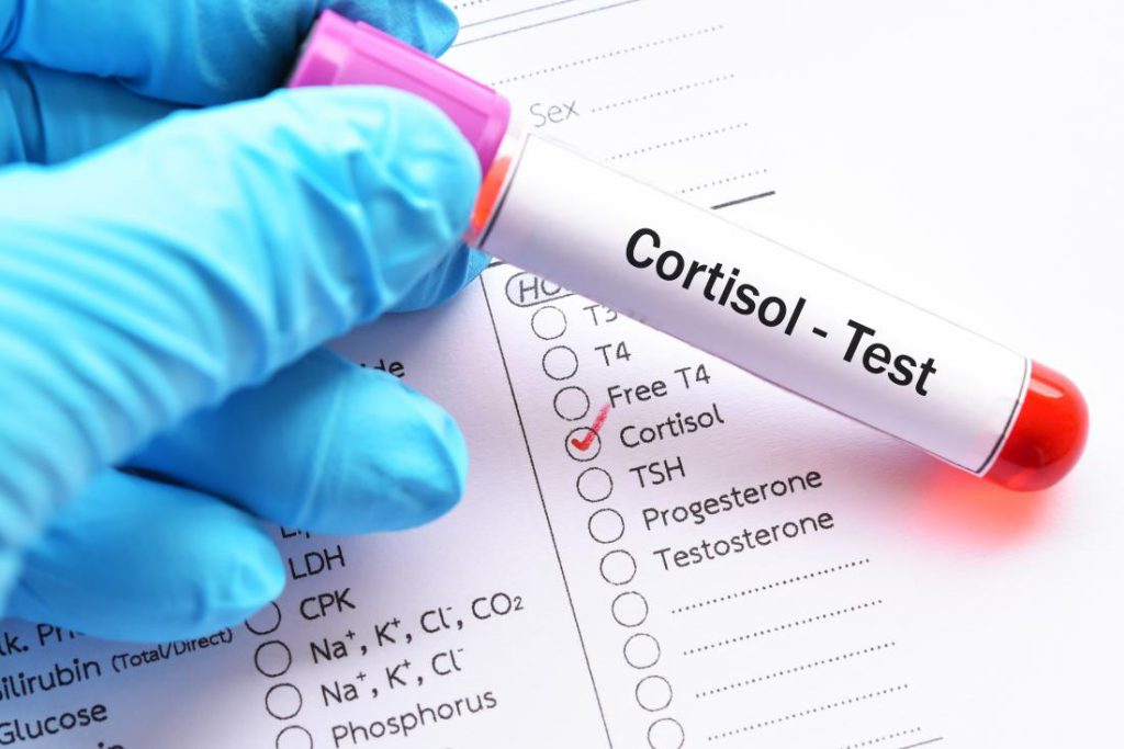Kortyzol – suplementacja na obniżenie hormonu stresu