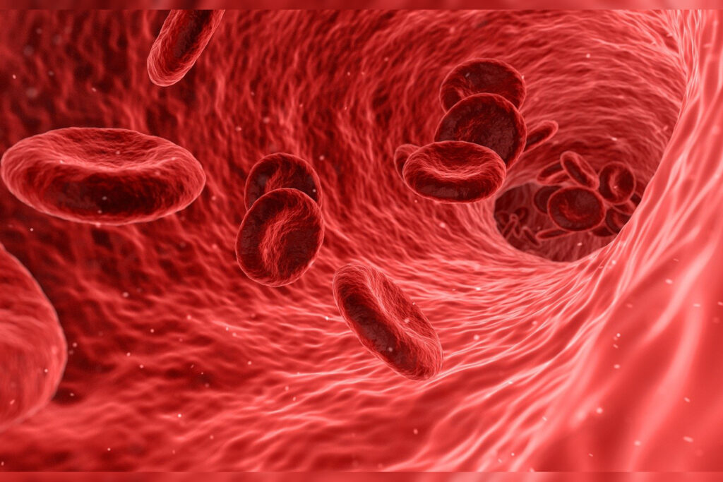 Co to jest anemia?