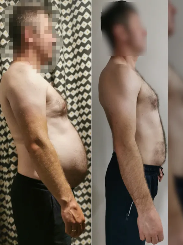 Boczna przemiana sylwetki mężczyzny po redukcji brzucha